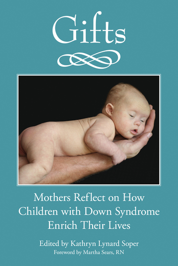 How long do adults with down syndrome live