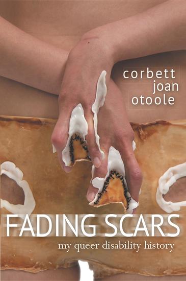 Fading Scars - My Queer Disability History - cover