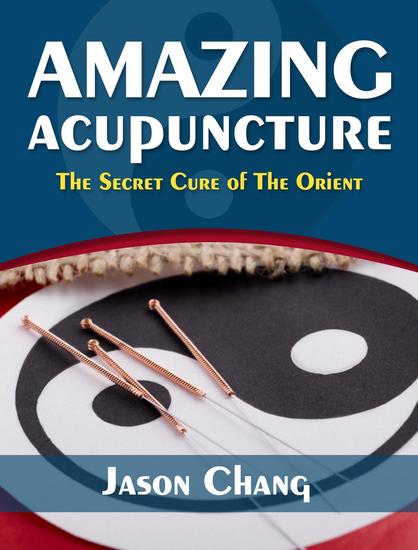 Amazing Acupuncture The Secret Cure of The Orient - cover