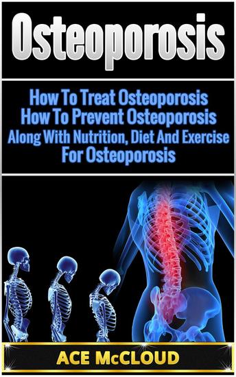 Osteoporosis: How To Treat Osteoporosis: How To Prevent Osteoporosis: Along With Nutrition Diet And Exercise For Osteoporosis - cover