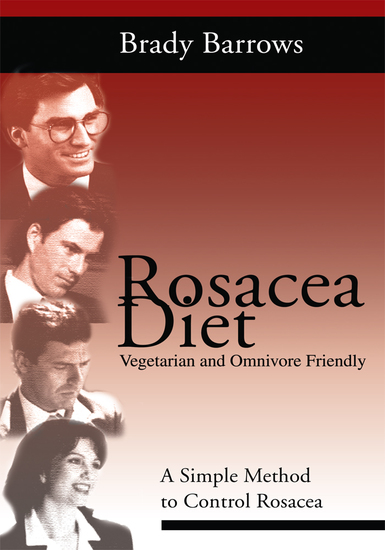 Rosacea Diet - A Simple Method to Control Rosacea - cover
