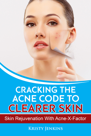 Cracking the Acne Code to Clearer Skin - Skin Rejuvenation with Acne-X-Factor - cover