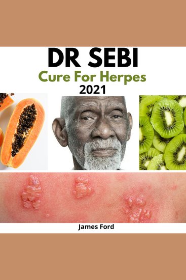 Dr Sebi Cure for Herpes 2021 - How to Naturally Cure Herpes Simplex