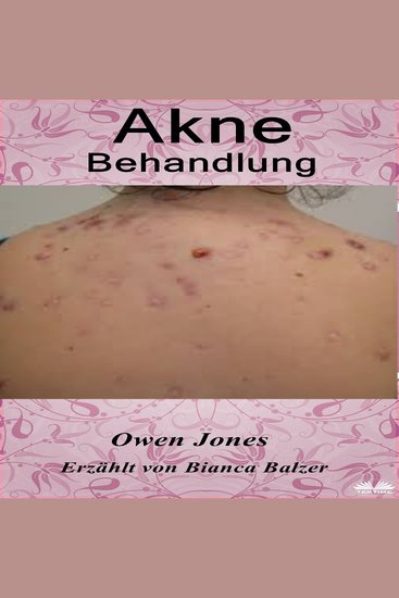 Akne-Behandlung - cover