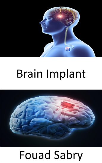 Brain Implant - The research that supports Neuralink Elon Musk's proposed brain chip - cover