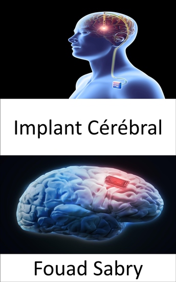 Implant Cérébral - La recherche qui soutient Neuralink la puce cérébrale proposée par Elon Musk - cover