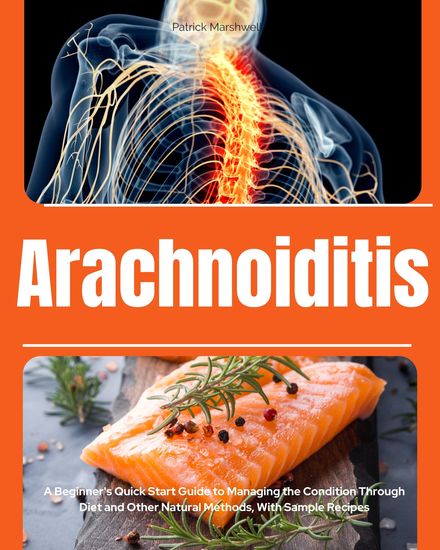 Arachnoiditis - A Beginner's Quick Start Guide to Managing the Condition Through Diet and Other Natural Methods With Sample Recipes - cover