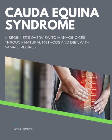 Cauda Equina Syndrome - A Beginner's Overview to Managing CES Through Natural Methods and Diet With Sample Recipes Kindle Edition - cover