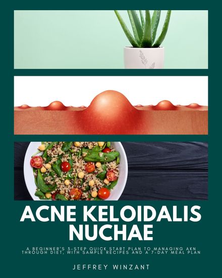 Acne Keloidalis Nuchae - A Beginner's 3-Step Quick Start Plan to Managing AKN Through Diet With Sample Recipes and a 7-Day Meal Plan - cover