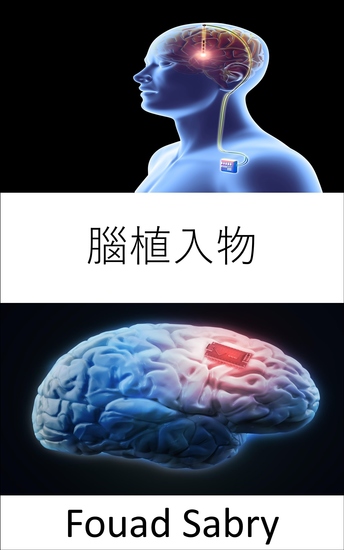 腦植入物 - 支持埃隆馬斯克提出的腦芯片 Neuralink 的研究 - cover
