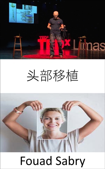 头部移植 - 意大利科学家称已成功实施世界首例人头移植手术 - cover