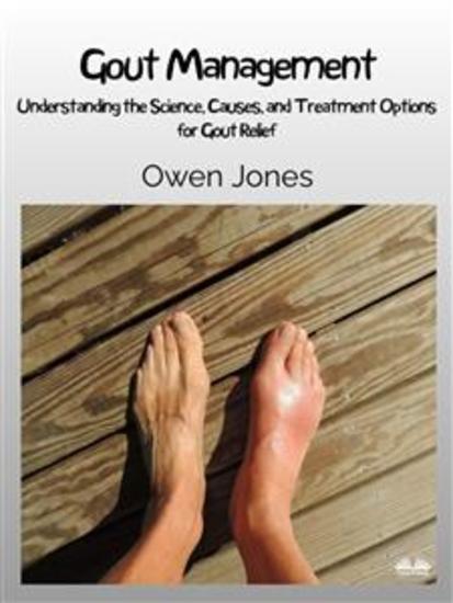 Gout Management - Understanding The Science Causes And Treatment Options For Gout Relief - cover