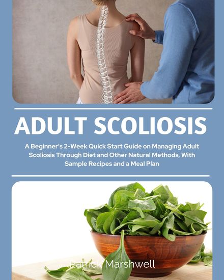 Adult Scoliosis - A Beginner's 2-Week Quick Start Guide on Managing Adult Scoliosis Through Diet and Other Natural Methods With Sample Recipes and a Meal Plan - cover