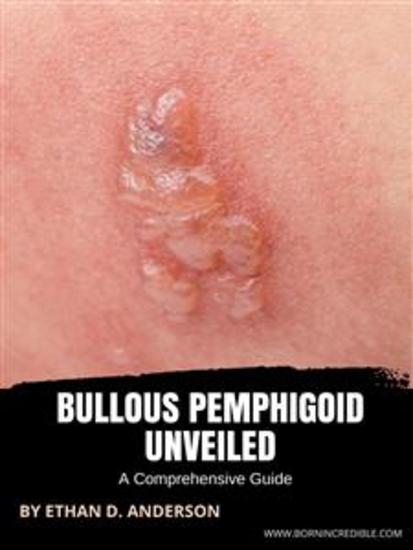 Bullous Pemphigoid Unveiled - A Comprehensive Guide - cover