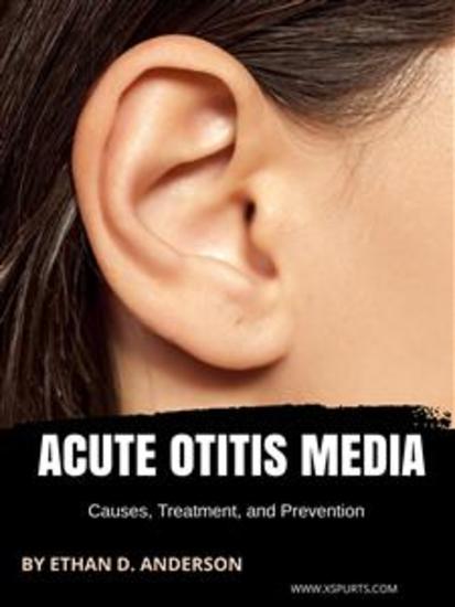 Acute Otitis Media: Causes Treatment and Prevention - cover