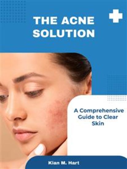 The Acne Solution - A Comprehensive Guide to Clear Skin - cover