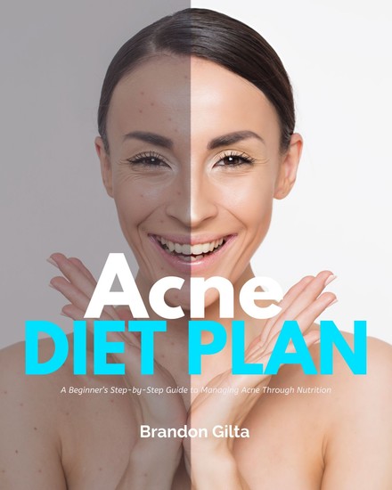 Acne Diet Plan - A Beginner’s Step-by-Step Guide to Managing Acne Through Nutrition With Curated Recipes and a Sample Meal Plan - cover