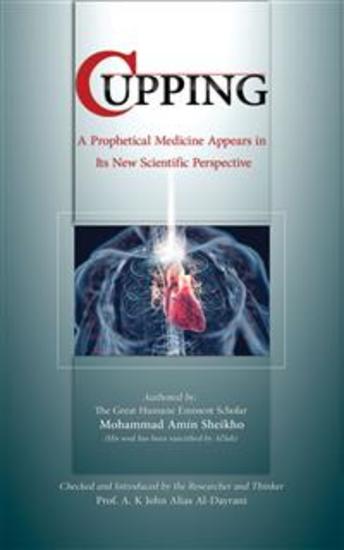 Cupping - A prophetical medicine appears in its new scientific perspective - cover