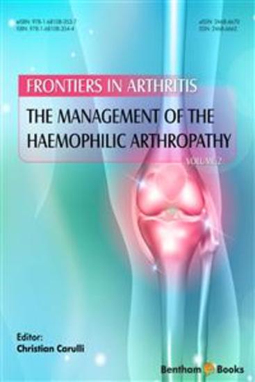 The Management of the Haemophilic Arthropathy - cover