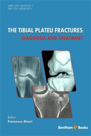 The Tibial Plateau Fractures: Diagnosis and Treatment - cover