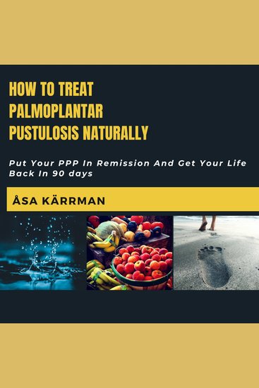 How To Treat Palmoplantar Pustulosis Naturally - Put Your PPP In Remission And Get Your Life Back in 90 days - cover