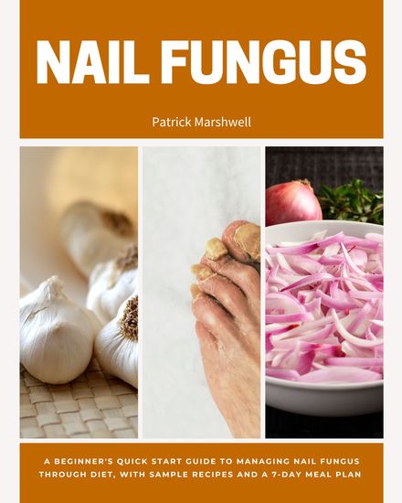 Nail Fungus - A Beginner's Quick Start Guide to Managing Nail Fungus Through Diet With Sample Recipes and a 7-Day Meal Plan - cover
