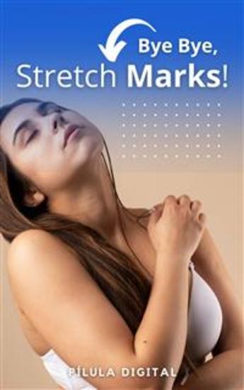 Bye Bye Stretch Marks! - Guide To Treating Stretch Marks - cover