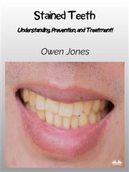Stained Teeth - Understanding Prevention And Treatment! - cover