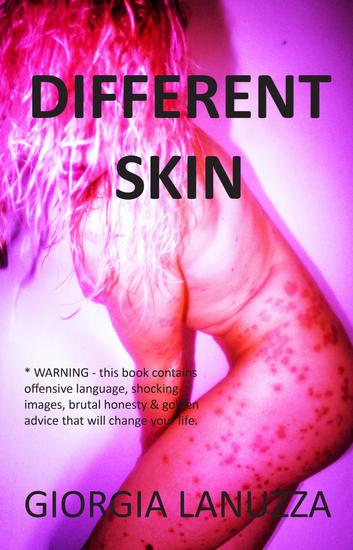 Different Skin - cover
