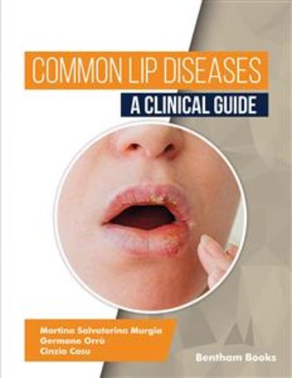 Common Lip Diseases: A Clinical Guide - cover