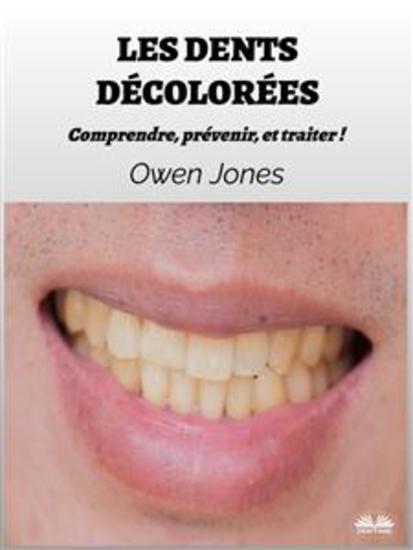Les Dents Décolorées - Comprendre Prévenir Et Traiter ! - cover