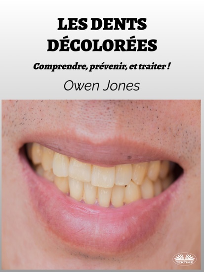 Les Dents Décolorées - Comprendre Prévenir Et Traiter ! - cover