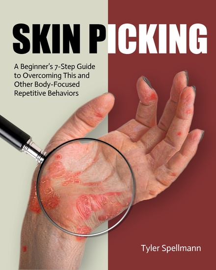 Skin Picking - A Beginner’s 7-Step Guide to Overcoming This and Other Body-Focused Repetitive Behaviors - cover