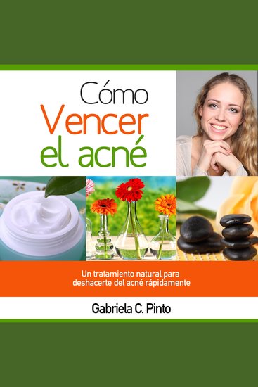 Cómo Vencer el Acné - Un tratamiento natural para deshacerte del acné rápidamente - cover