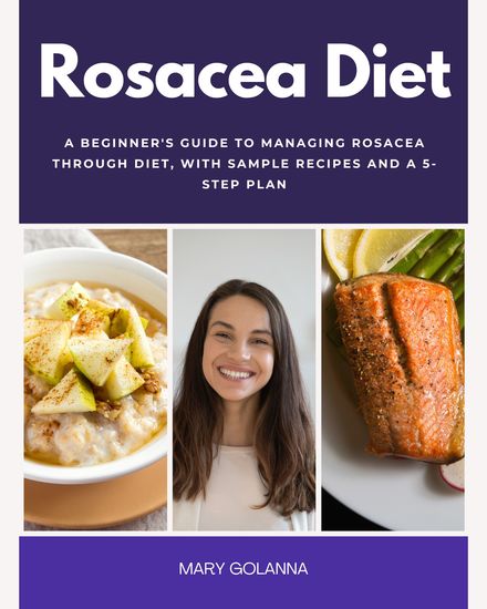Rosacea Diet - A Beginner's Guide to Managing Rosacea Through Diet With Sample Recipes and a 5-Step Plan - cover