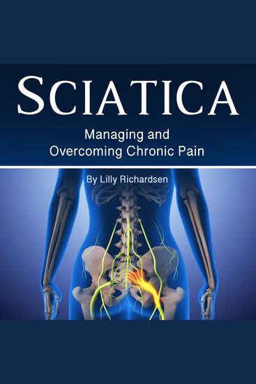 Sciatica - Managing and Overcoming Chronic Pain - cover