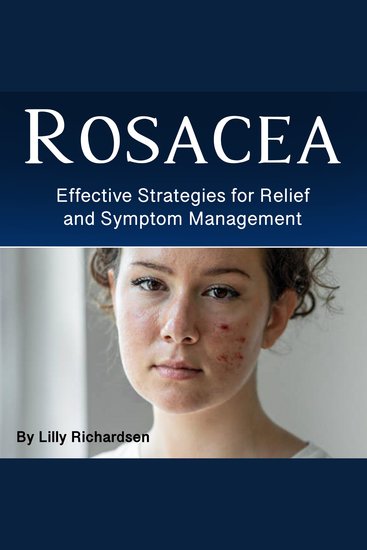 Rosacea - Effective Strategies for Relief and Symptom Management - cover