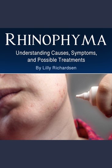 Rhinophyma - Understanding Causes Symptoms and Possible Treatments - cover