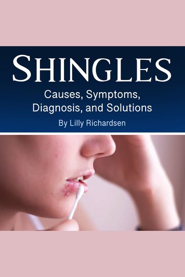 Shingles - Causes Symptoms Diagnosis and Solutions - cover