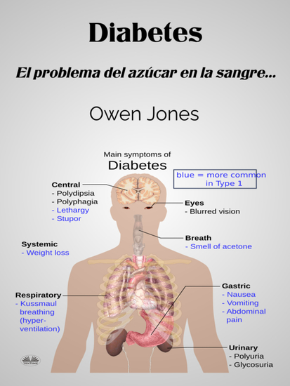 Diabetes - El Problema Del Azúcar En La Sangre - cover
