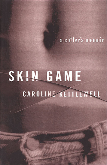 Skin Game - A Cutter's Memoir - cover
