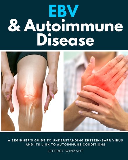 EBV & Autoimmune Disease - A Beginner’s Guide to Understanding Epstein-Barr Virus and Its Link to Autoimmune Conditions Jeffrey Winzant - cover