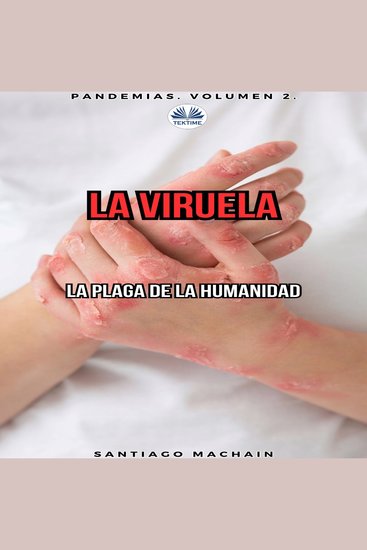 La Viruela - cover