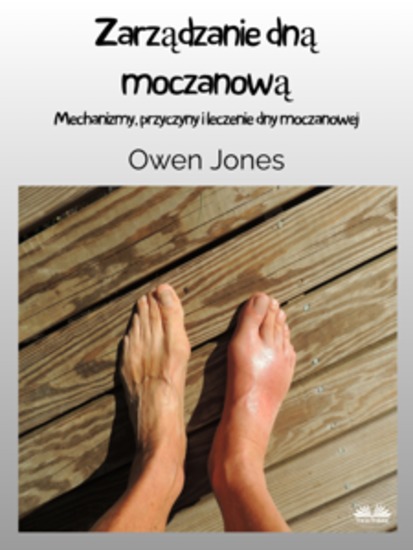Zarządzanie Dną Moczanową - Mechanizmy Przyczyny I Leczenie Dny Moczanowej - cover