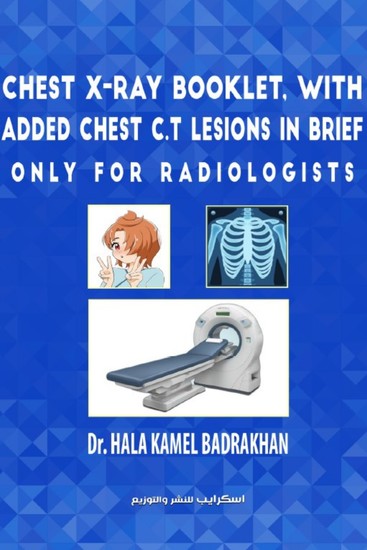 Chest X-Ray Booklet with added Chest CT Lesions in brief Only for Radiologists - cover