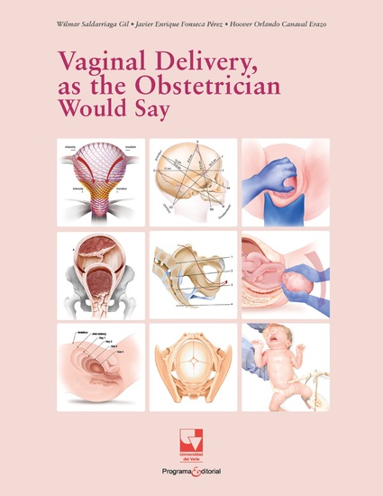 Vaginal Delivery as the Obstetrician Would Say - cover