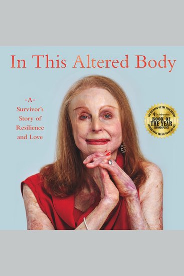In This Altered Body - A Survivor’s Story of Resilience and Love - cover