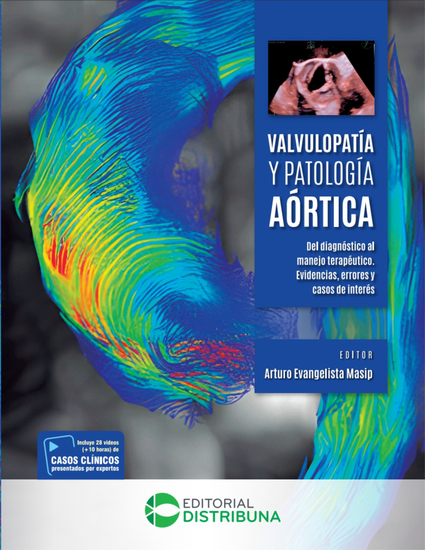 Valvulopatía y patología aórtica - Del diagnóstico al manejo terapéutico Evidencias errores y casos de interés - cover