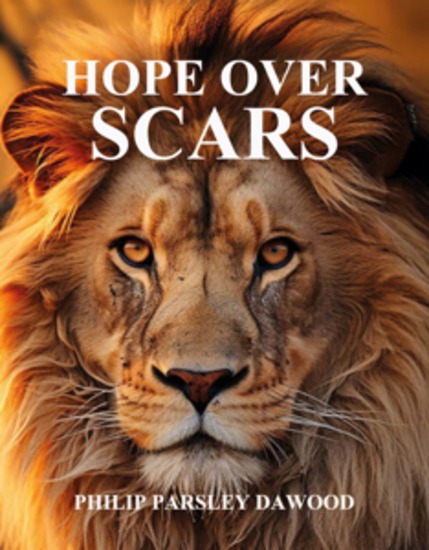 Hope Over Scars - How God Turns Pain Into Purpose And Scars Into Testimonies - cover