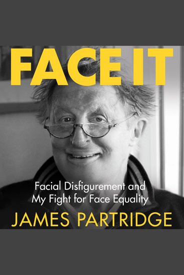 Face It - Facial Disfigurement and My Fight For Face Equality - cover